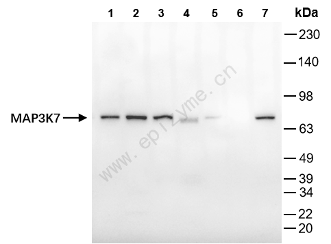 Anti-TAK1 Rabbit mAb [20G80N82]