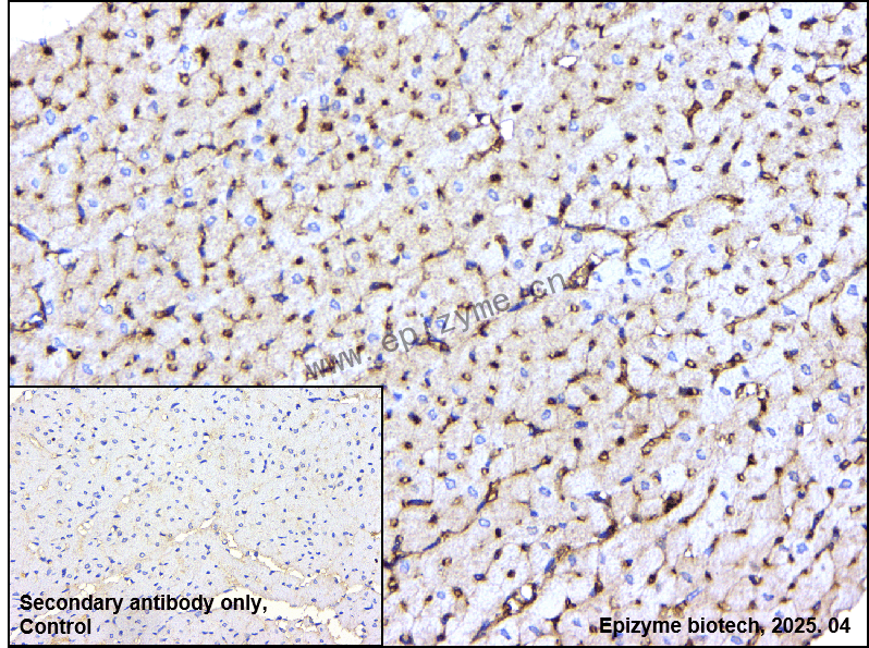 Anti-Extracellular matrix protein 1 Rabbit mAb [92C44P15]