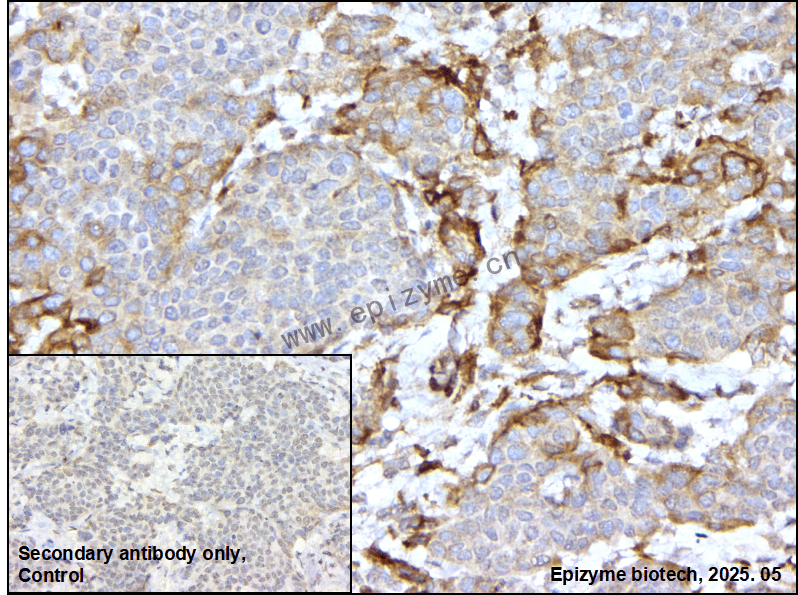 Anti-Extracellular matrix protein 1 Rabbit mAb [92C44P15]