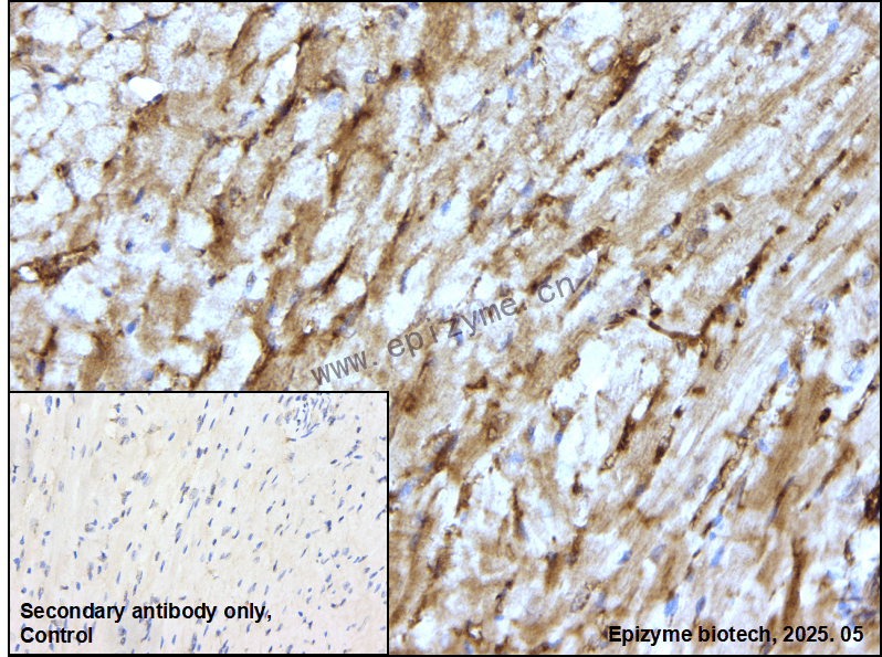 Anti-Extracellular matrix protein 1 Rabbit mAb [92C44P15]