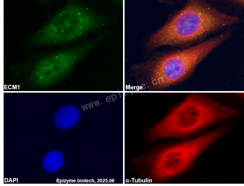 Anti-Extracellular matrix protein 1 Rabbit mAb [92C44P15]