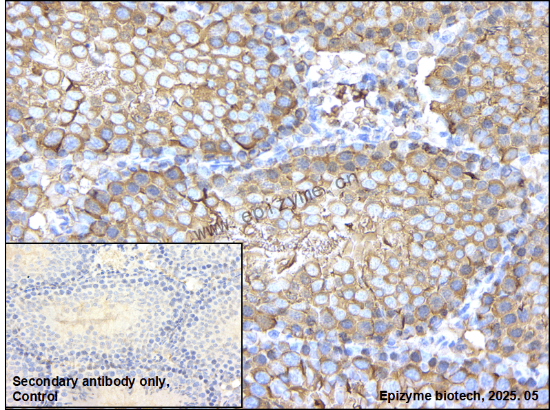 Anti-Hsp90 alpha Rabbit mAb [65Y40N96]
