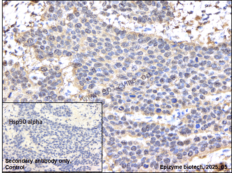 Anti-Hsp90 alpha Rabbit mAb [65Y40N96]