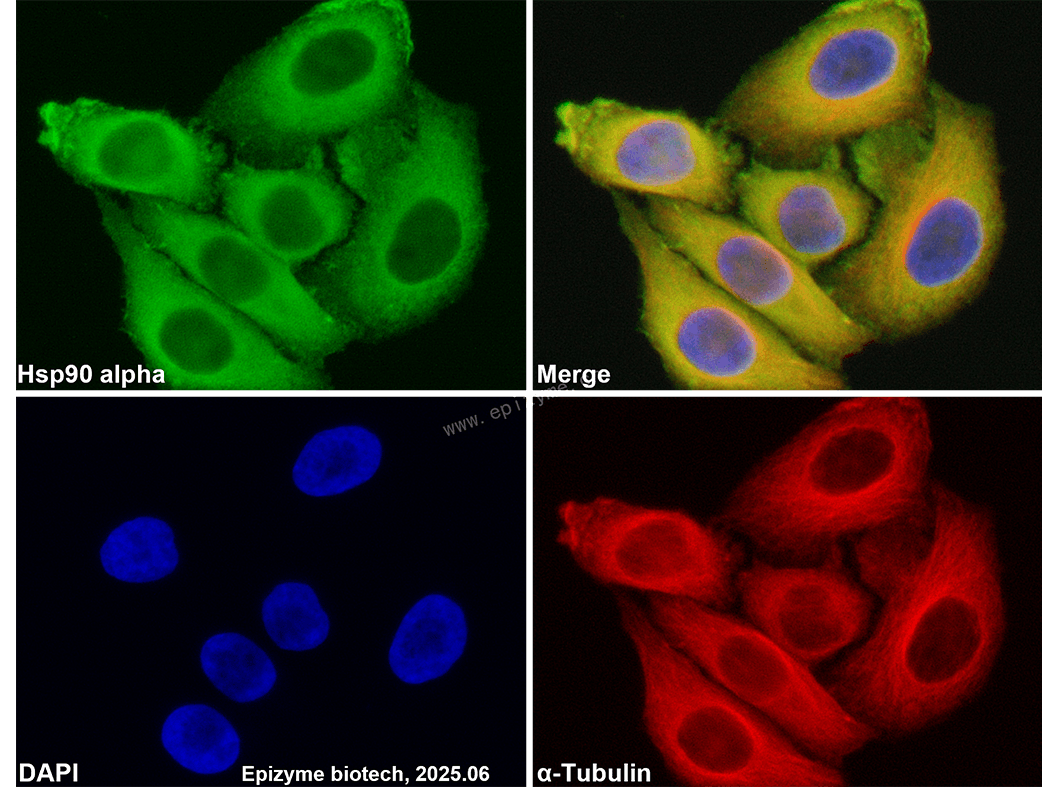 Anti-Hsp90 alpha Rabbit mAb [65Y40N96]