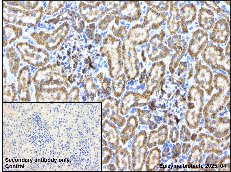 Anti-Epac1 Rabbit mAb [57T72D78]