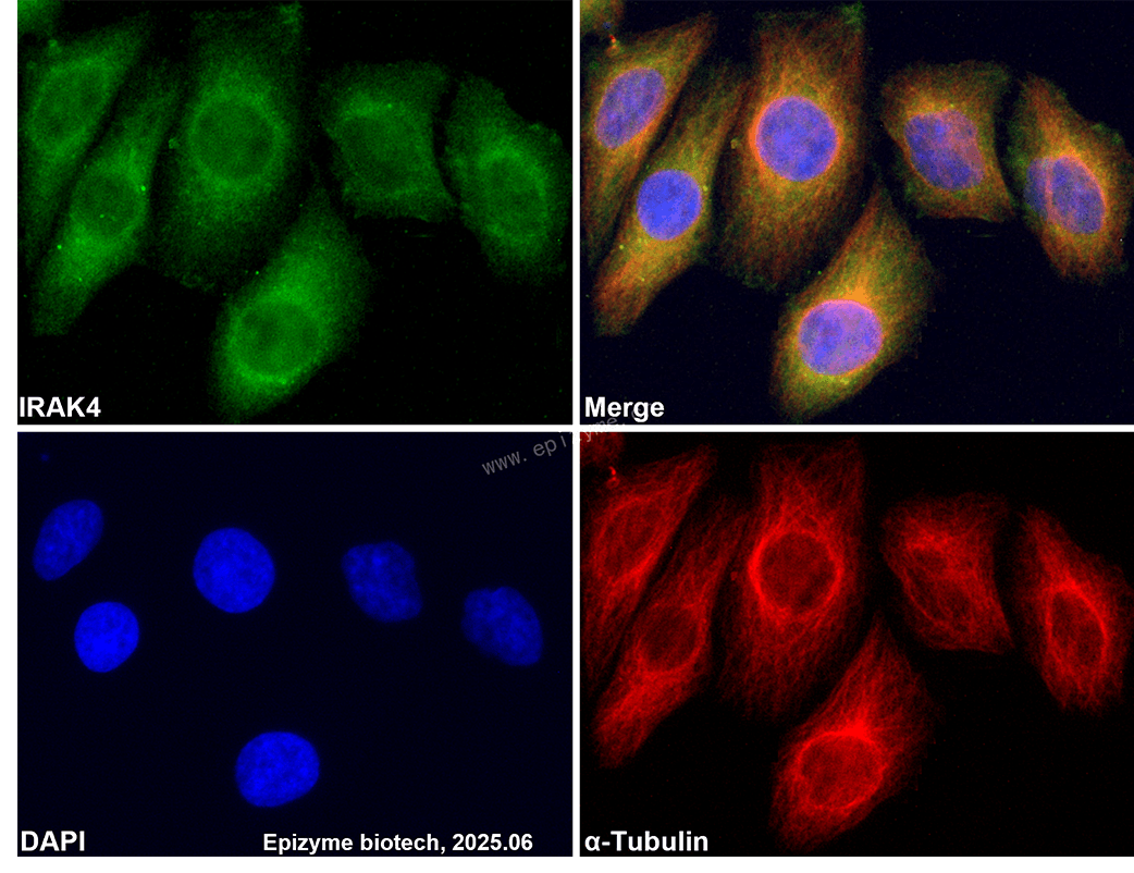Anti-IRAK4 Rabbit mAb [31G40A39]