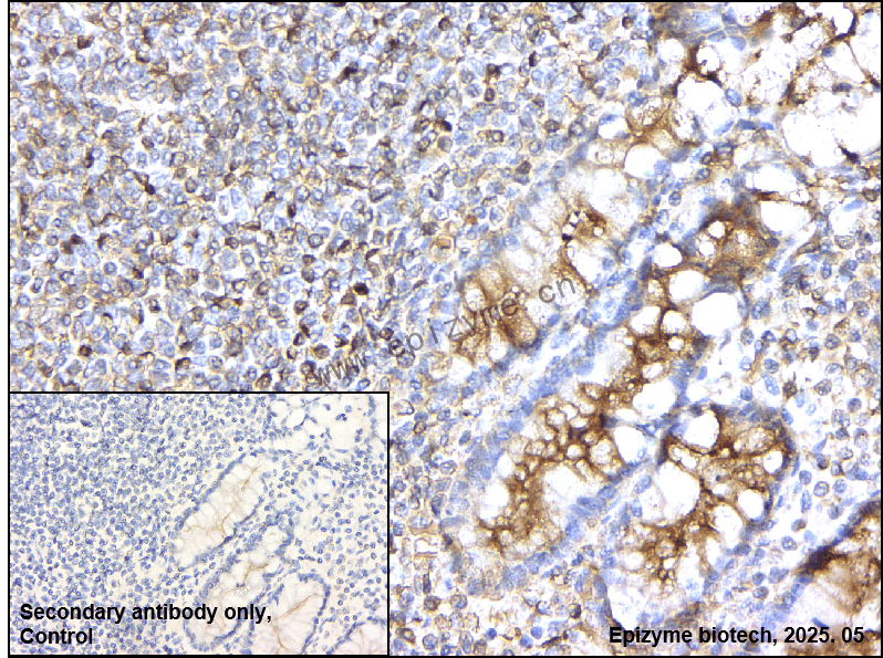 Anti-IRAK4 Rabbit mAb [31G40A39]
