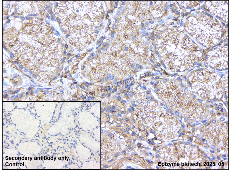Anti-IRAK4 Rabbit mAb [31G40A39]
