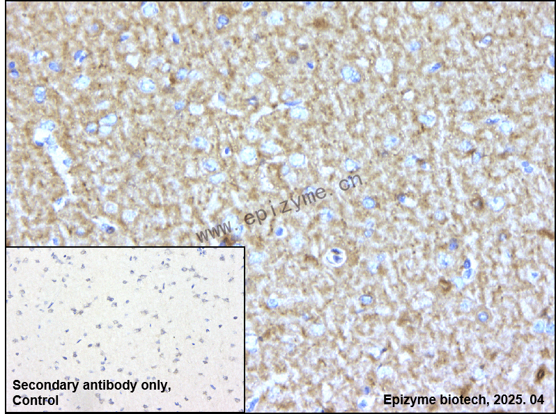 Anti-Caspr Rabbit mAb [35F85T09]