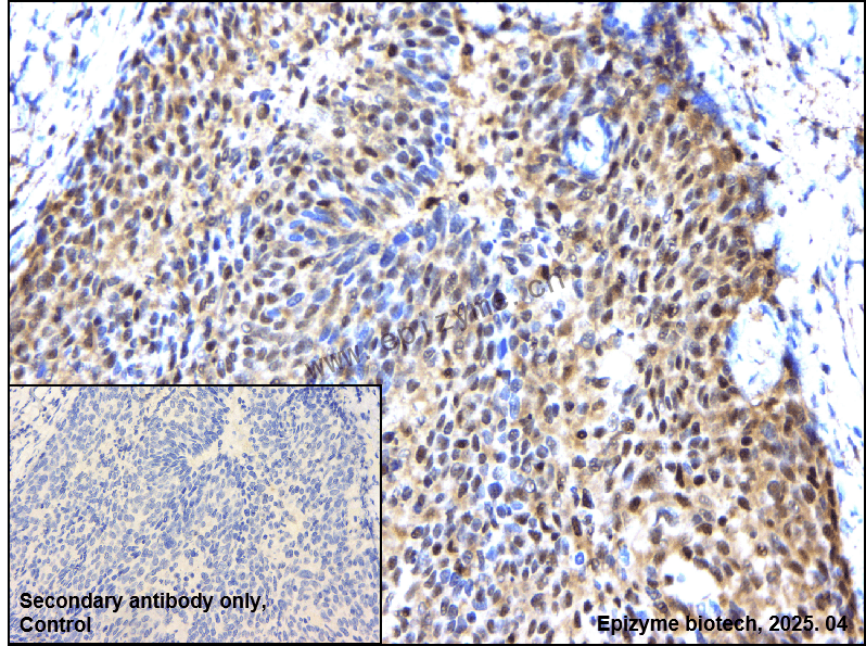Anti-STAT4 Rabbit mAb [37J76R51]