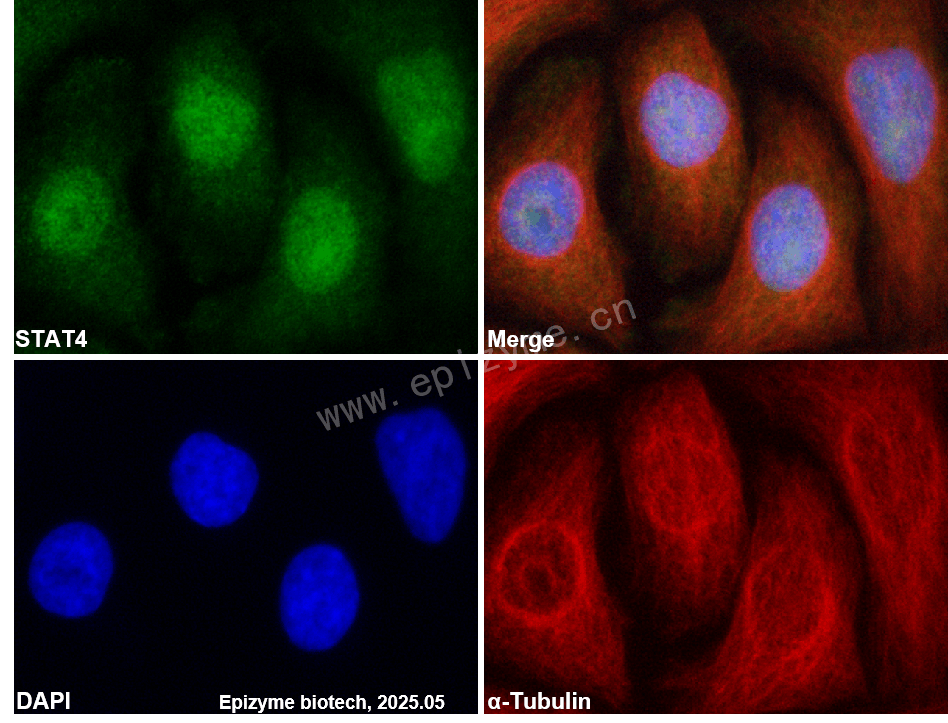 Anti-STAT4 Rabbit mAb [37J76R51]