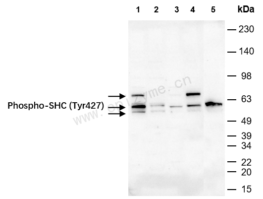 Anti-Phospho-SHC (Tyr427) Rabbit mAb [69G89Q59]