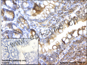 Anti-Phospho-SHC (Tyr427) Rabbit mAb [69G89Q59]