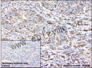 Anti-Phospho-SHC (Tyr427) Rabbit mAb [69G89Q59]