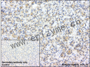 Anti-Phospho-PKC delta (Tyr311) Rabbit mAb [24N54D16]