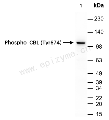 Anti-Phospho-CBL (Tyr674) Rabbit mAb [70D55F73]