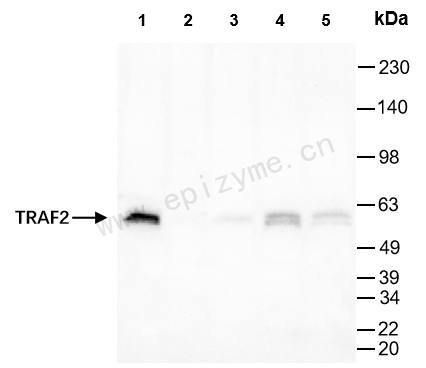 Anti-TRAF2 Rabbit mAb [44K45S95]