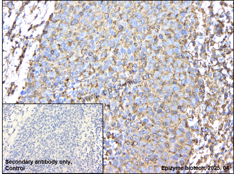 Anti-TRAF2 Rabbit mAb [44K45S95]