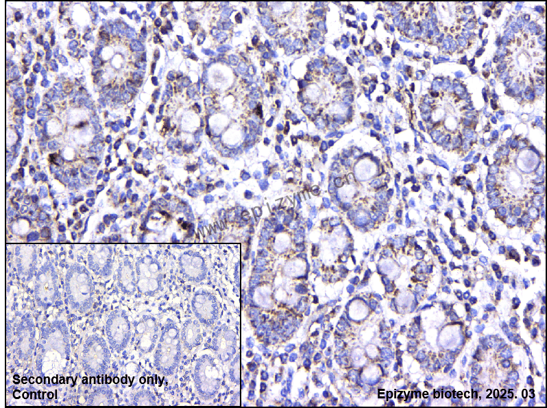 Anti-PI3 kinase p100 Rabbit mAb [60G93Y59]