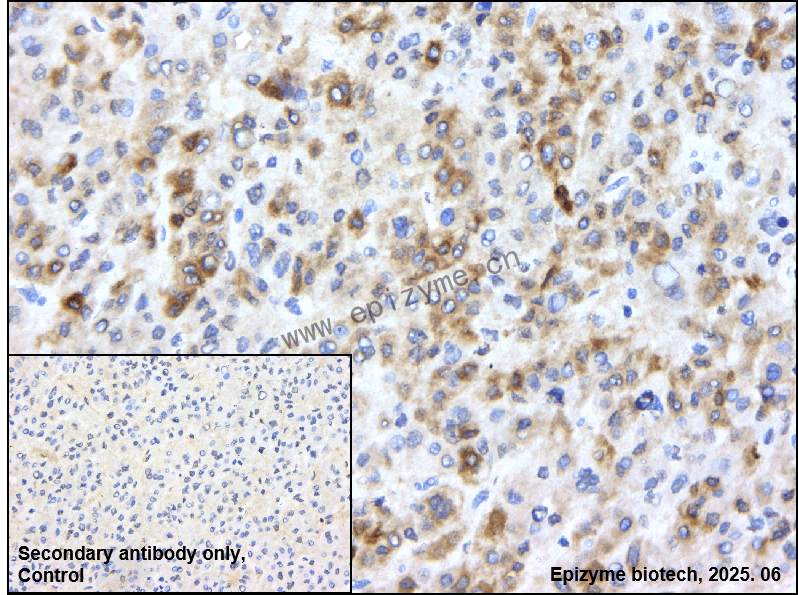 Anti-PEG10 Rabbit mAb [95G87E68]