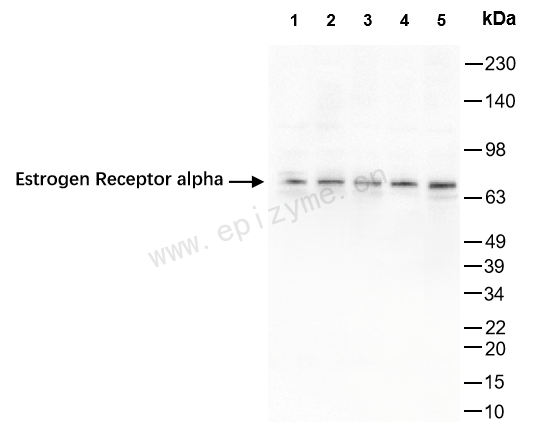 Anti-Estrogen Receptor alpha Rabbit mAb [31S10A23]