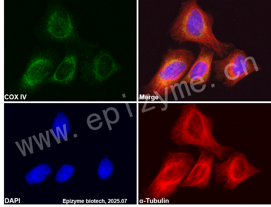 Anti-COX IV Rabbit mAb [81F46G51]