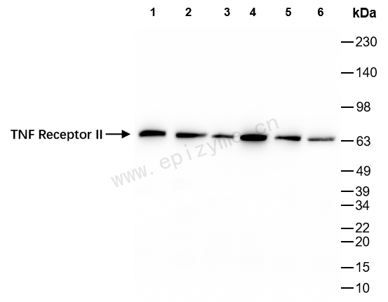 Anti-TNF Receptor II Rabbit mAb [63G67L55]