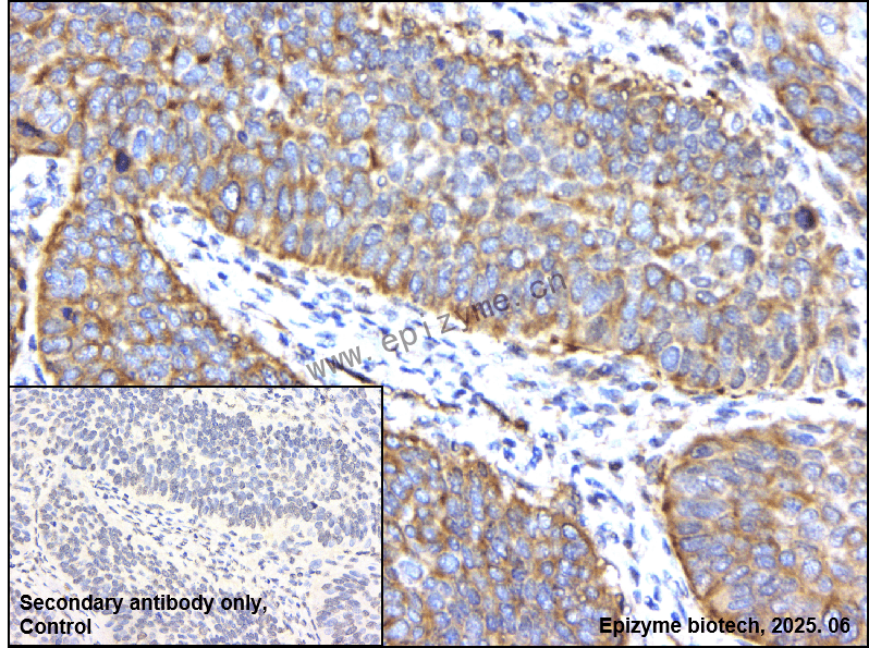 Anti-TNF Receptor II Rabbit mAb [63G67L55]