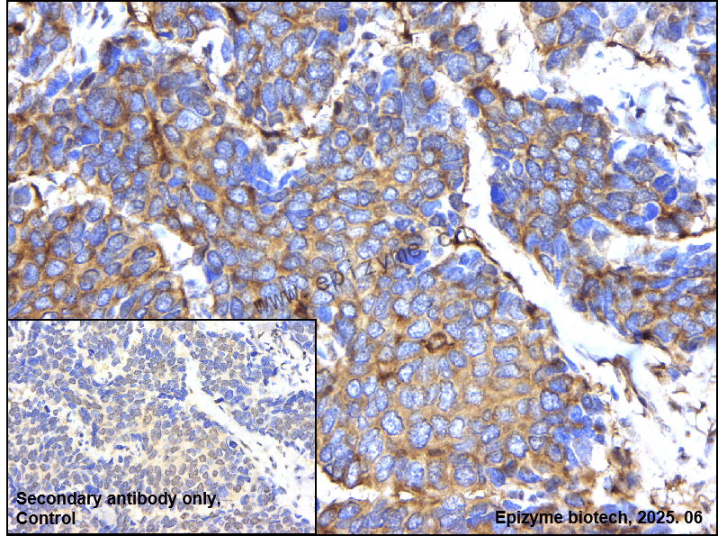Anti-TNF Receptor II Rabbit mAb [63G67L55]