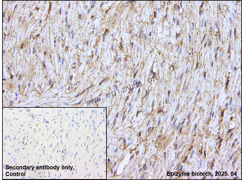 Anti-Integrin linked ILK Rabbit mAb [84N28B06]