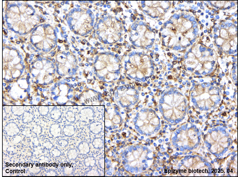 Anti-Integrin linked ILK Rabbit mAb [84N28B06]
