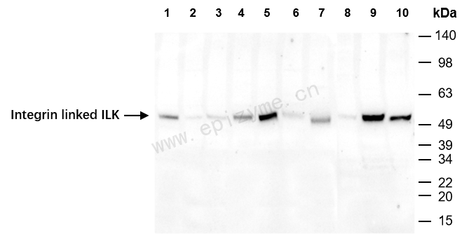 Anti-Integrin linked ILK Rabbit mAb [84N28B06]