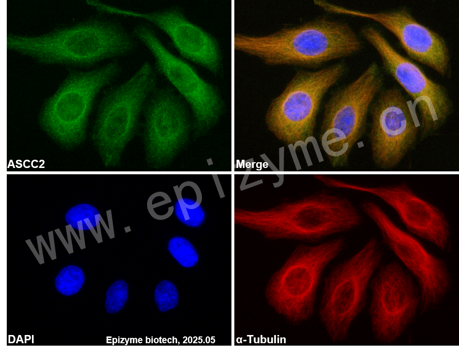 Anti-ASCC2 Rabbit mAb [79S55K29]
