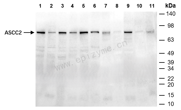 Anti-ASCC2 Rabbit mAb [79S55K29]