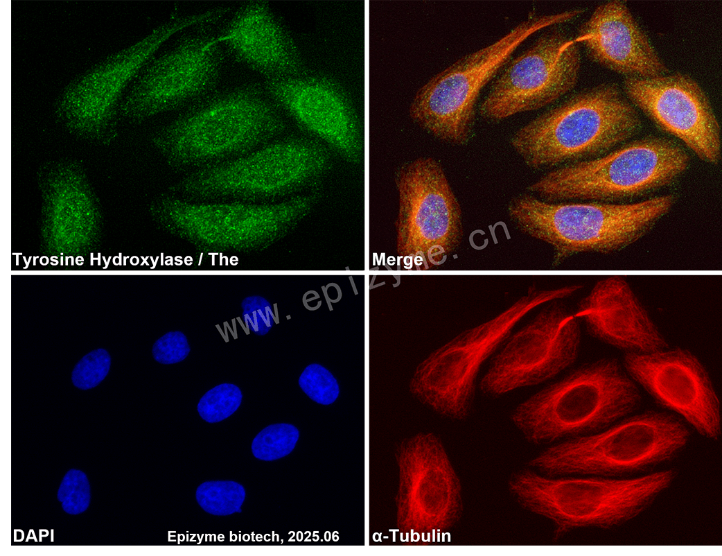 Anti-Tyrosine Hydroxylase Rabbit mAb [66P93D10]