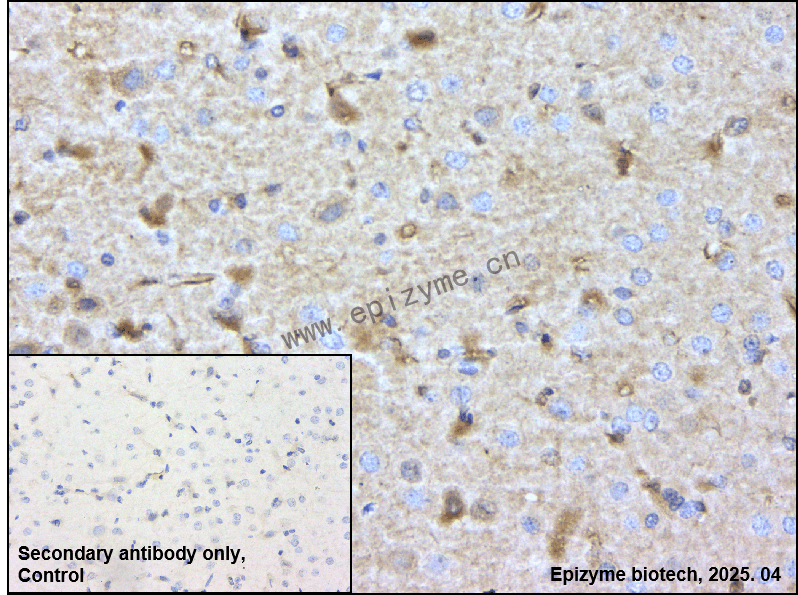 Anti-Tyrosine Hydroxylase Rabbit mAb [66P93D10]