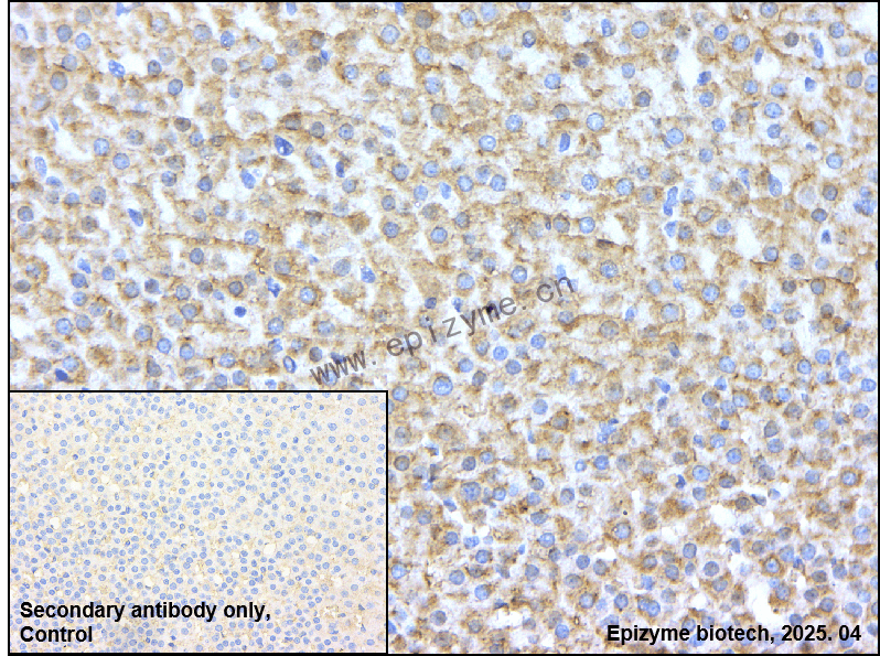 Anti-Tyrosine Hydroxylase Rabbit mAb [66P93D10]