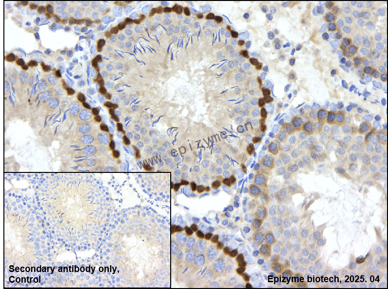 Anti-Bub1 Rabbit mAb [21E99I37]