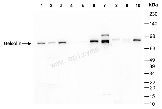 Anti-Gelsolin Rabbit mAb [40E56K90]