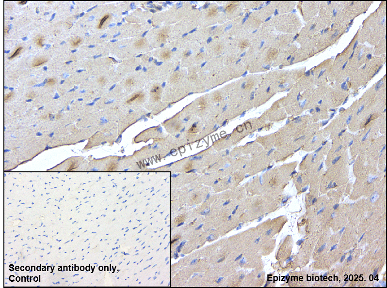 Anti-Gelsolin Rabbit mAb [40E56K90]