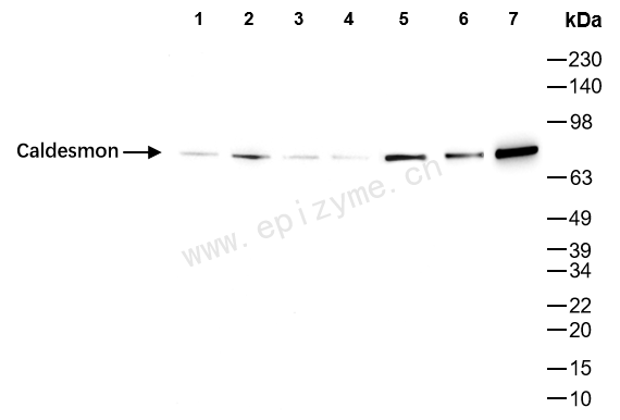 Anti-Caldesmon Rabbit mAb [77K41K33]