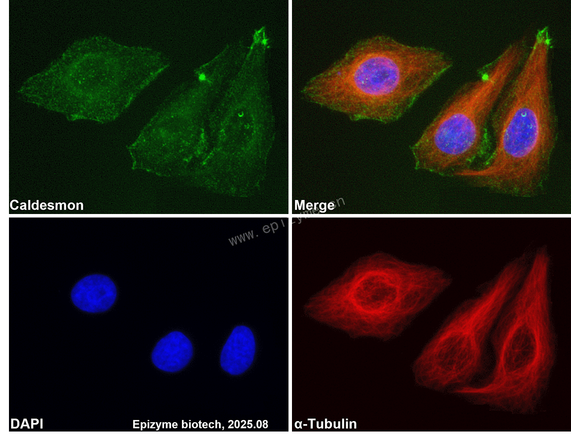Anti-Caldesmon Rabbit mAb [77K41K33]