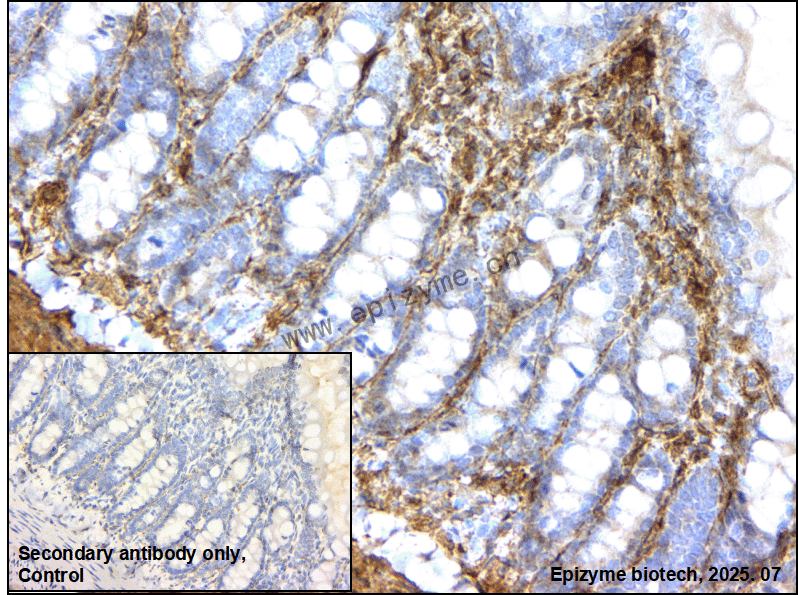 Anti-Caldesmon Rabbit mAb [77K41K33]