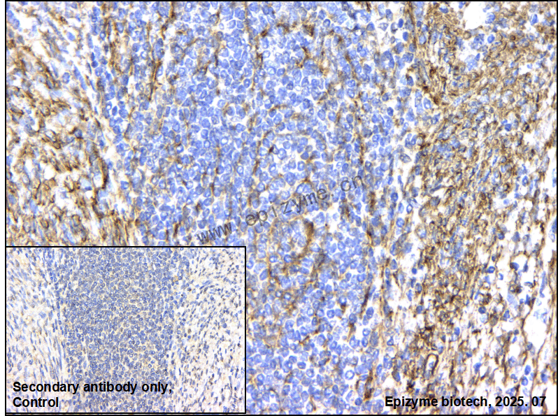 Anti-Caldesmon Rabbit mAb [77K41K33]