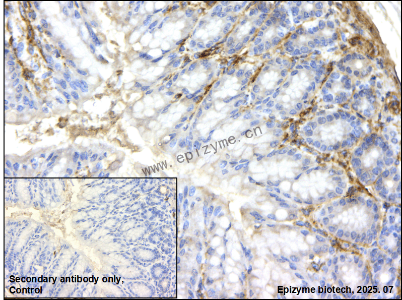 Anti-Caldesmon Rabbit mAb [77K41K33]