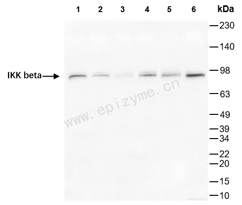 Anti-IKK beta Rabbit mAb [75M40M20]