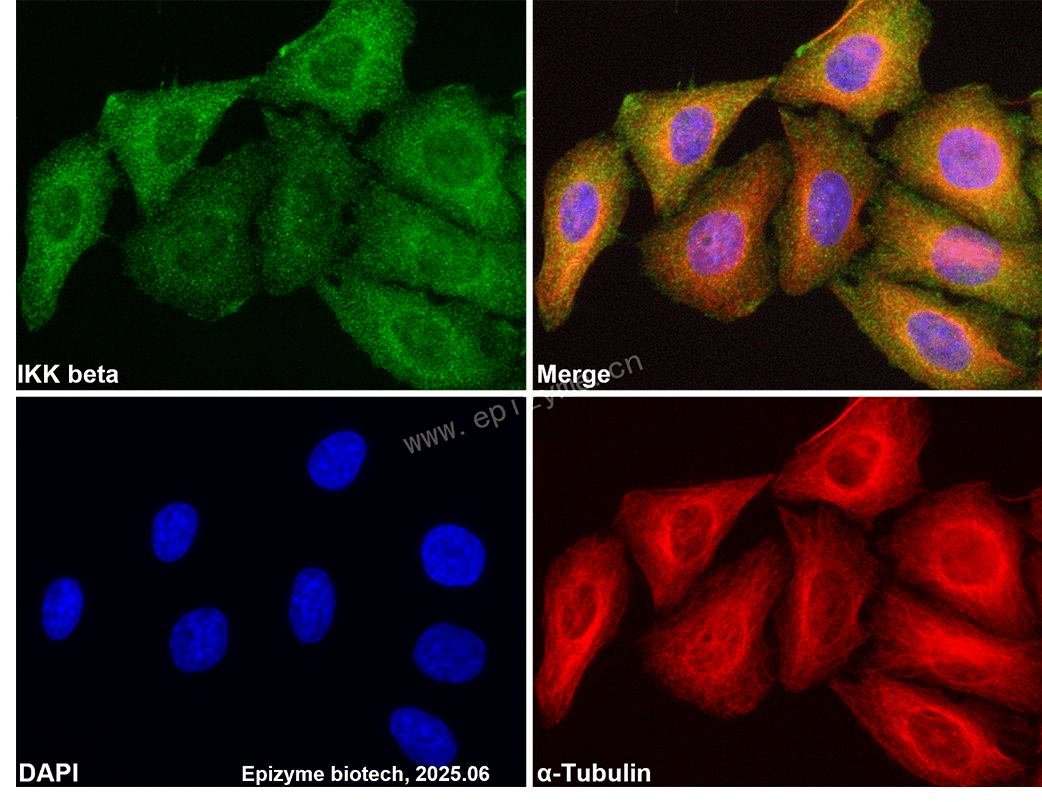 Anti-IKK beta Rabbit mAb [75M40M20]