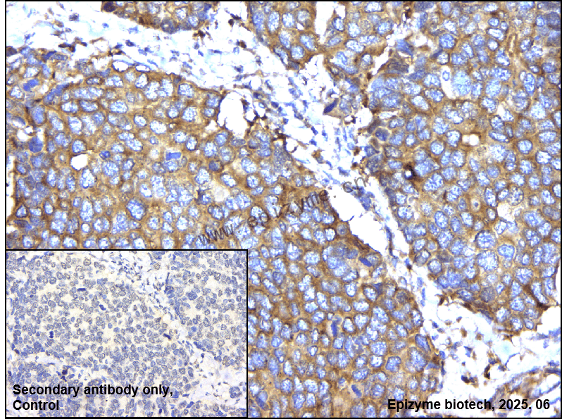 Anti-IKK beta Rabbit mAb [75M40M20]