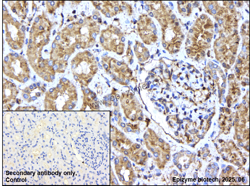 Anti-IKK beta Rabbit mAb [75M40M20]