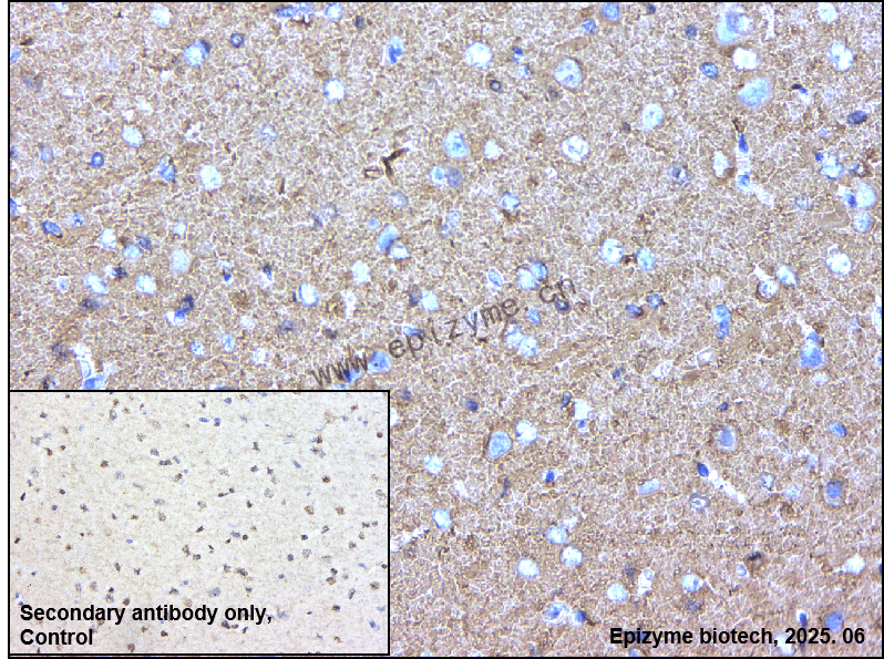 Anti-ADRA1A Rabbit mAb [53L84L63]